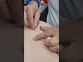 Asmr Massage Shorts Youtubeshorts Turkishbarber