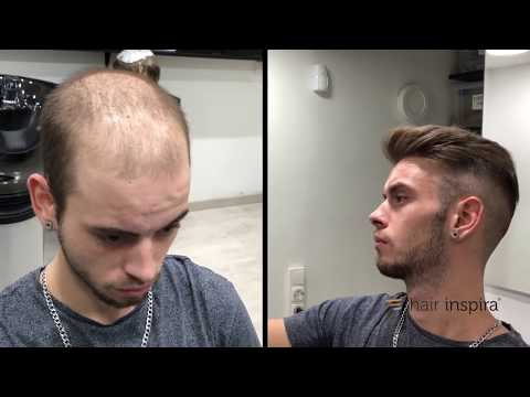 Hair Replacement fitting video (David) part 2 - Hair...