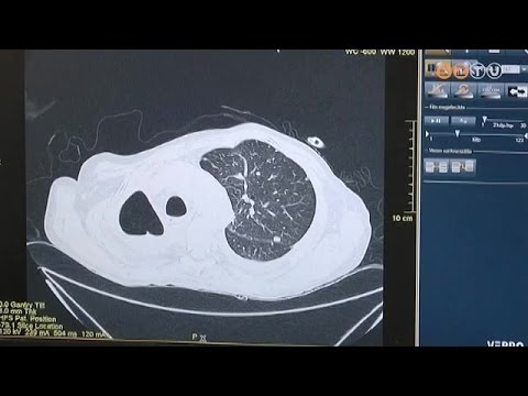 az összes osteochondrozis készítmény