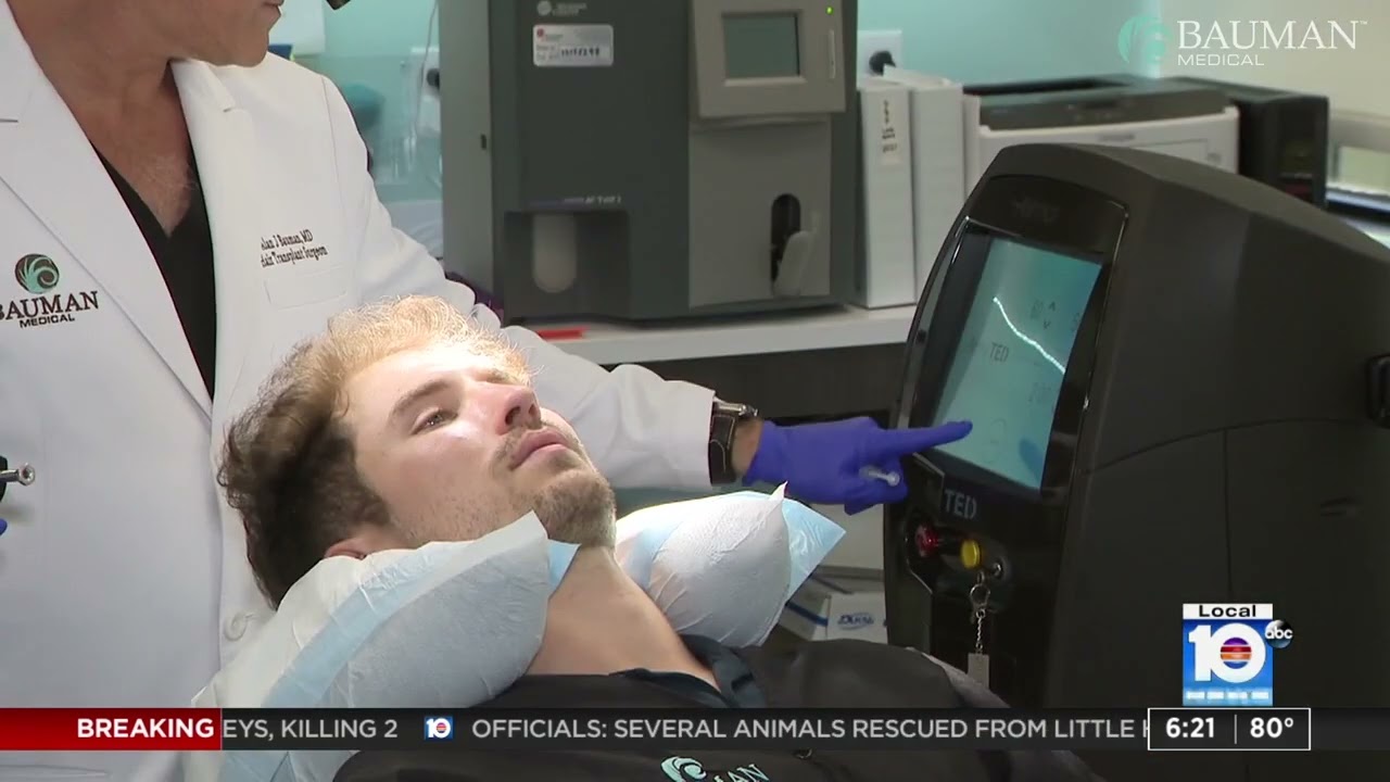TED Hair Restoration Offers Needle-Free, Pain-Free Hair Growth - Dr Alan Bauman Local10 Miami News