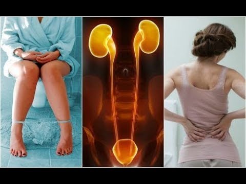 Schlamm-Anwendungen auf dem Gelenke Arthrose Mehrschicht-Computertomographie von Gelenken