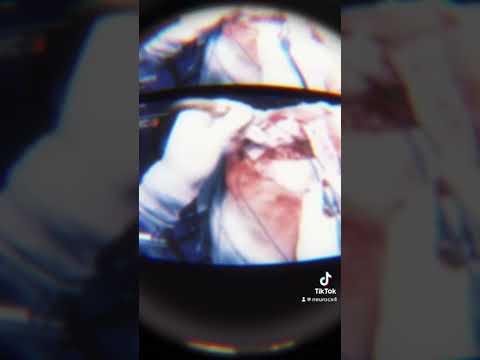 Jose Alan Santos Locia-33