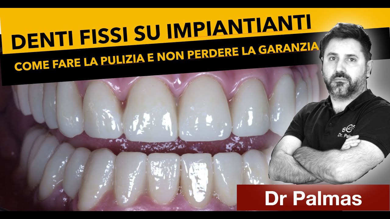 Come pulire i denti avvitati su impianti e non invalidare la garanzia