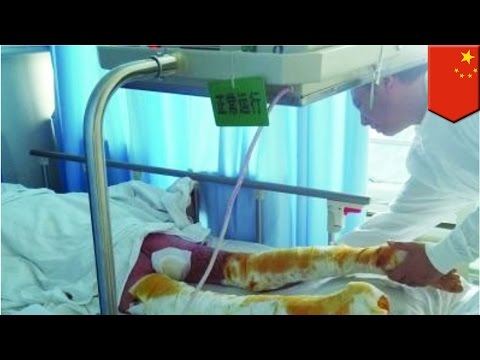 Kung paano sa alisin ang taba sa pagitan ng braso Maubos cocktail para sa pagbaba ng timbang