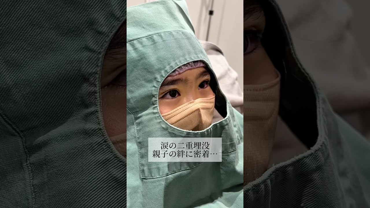 【二重整形】#shorts 親子の絆に密着