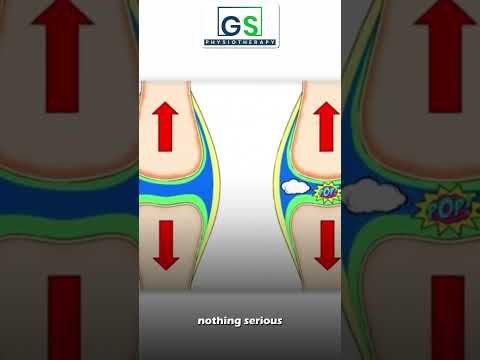 Why Do Your Joints Crack During Workouts? | GS Physiotherapy Explains Joint Pain & Relief