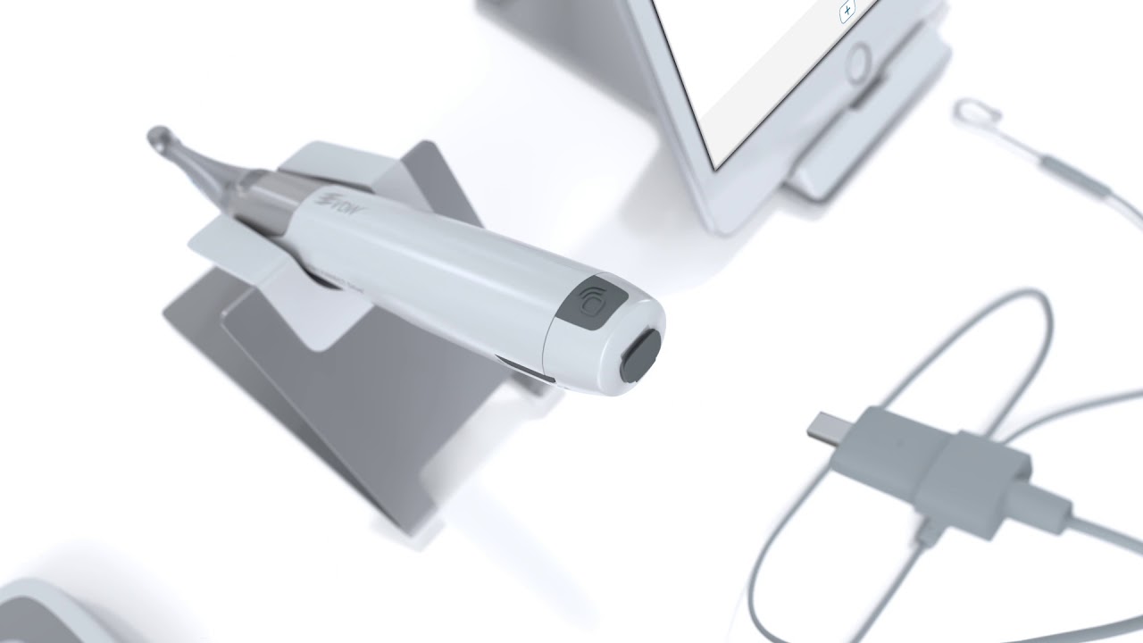 VDW ENdo it your way