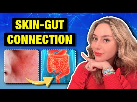 Can Healing Your Gut Really Transform Your Skin? Dermatologist Explains Gut Health | Dr. Idriss