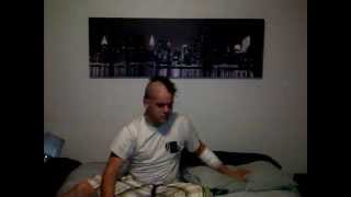 Hair cut prank while asleep.The aftermath