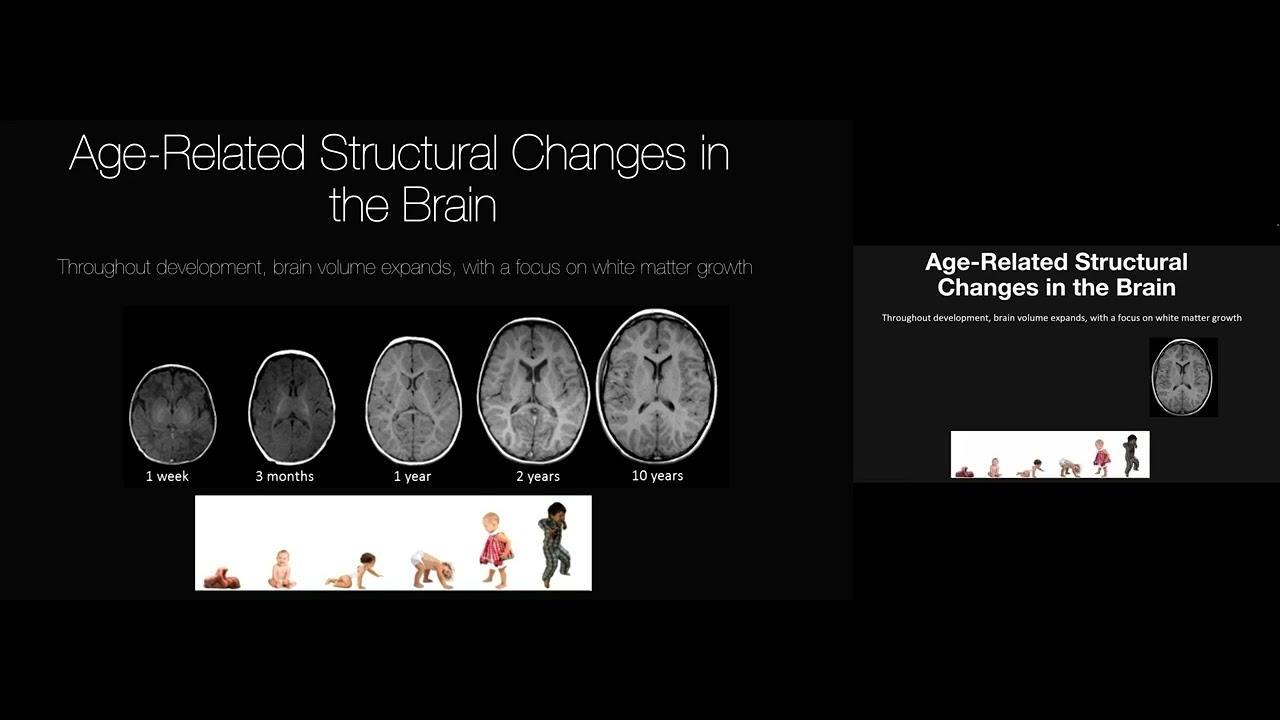 Aviv Mezer - "The Human Brain: Structural Changes..."