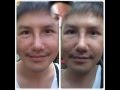 ร้อยไหม หน้าเรียว