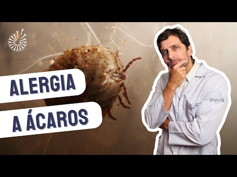 ALERGIA A ACARO E POEIRA. Alergista orienta diagnóstico e tratamento.  #alergias #ácaros  #rinite