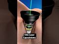 Clearing cloudy vision after cataract surgery (3D Animation)