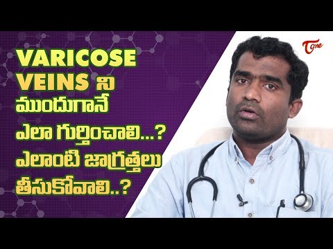 What Is Varicose Veins & How Can It Be Treated ? | Dr. Shailesh Kumar Garge | TeluguOne