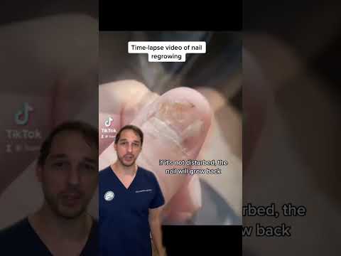 Hand surgeon Nick Pappas MD discusses nail growth #acrylicnails #Nail #Regrow #Medical #Hand #Finger