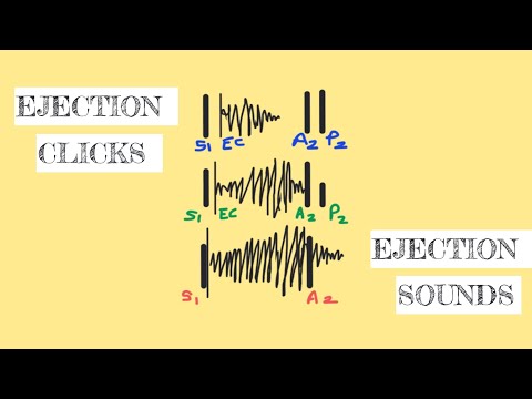 Ejection sounds/ ejection clicks