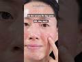 SKIN 1004 Madagascar Centella Poremizing Beplain Mung Bean Pore Tight Up Serums Pores Kbeauty