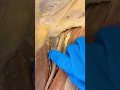 Look How Cool These Blood Vessels Are!