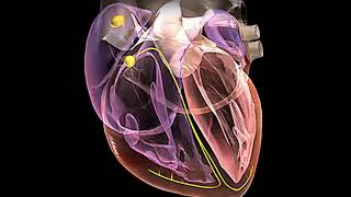 Arrhythmias  || Health Video | MedlinePlus