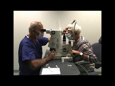 Selective laser trabeculoplasty SLT,  glaucoma treatment