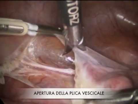 Mal di schiena che si può mettere Cataplasma per il dolore alle articolazioni del ginocchio