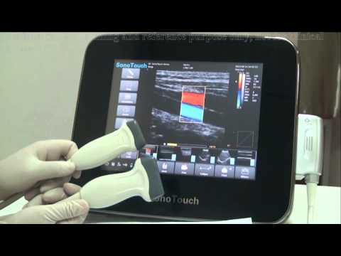 download lagu mp3 mp4 Sonotouch 30, download lagu Sonotouch 30 gratis, unduh video klip Sonotouch 30