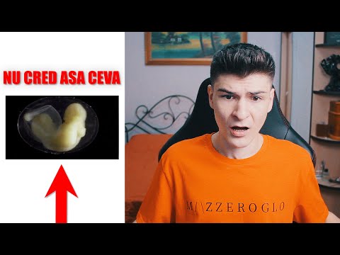 s a născut o fată cu penis