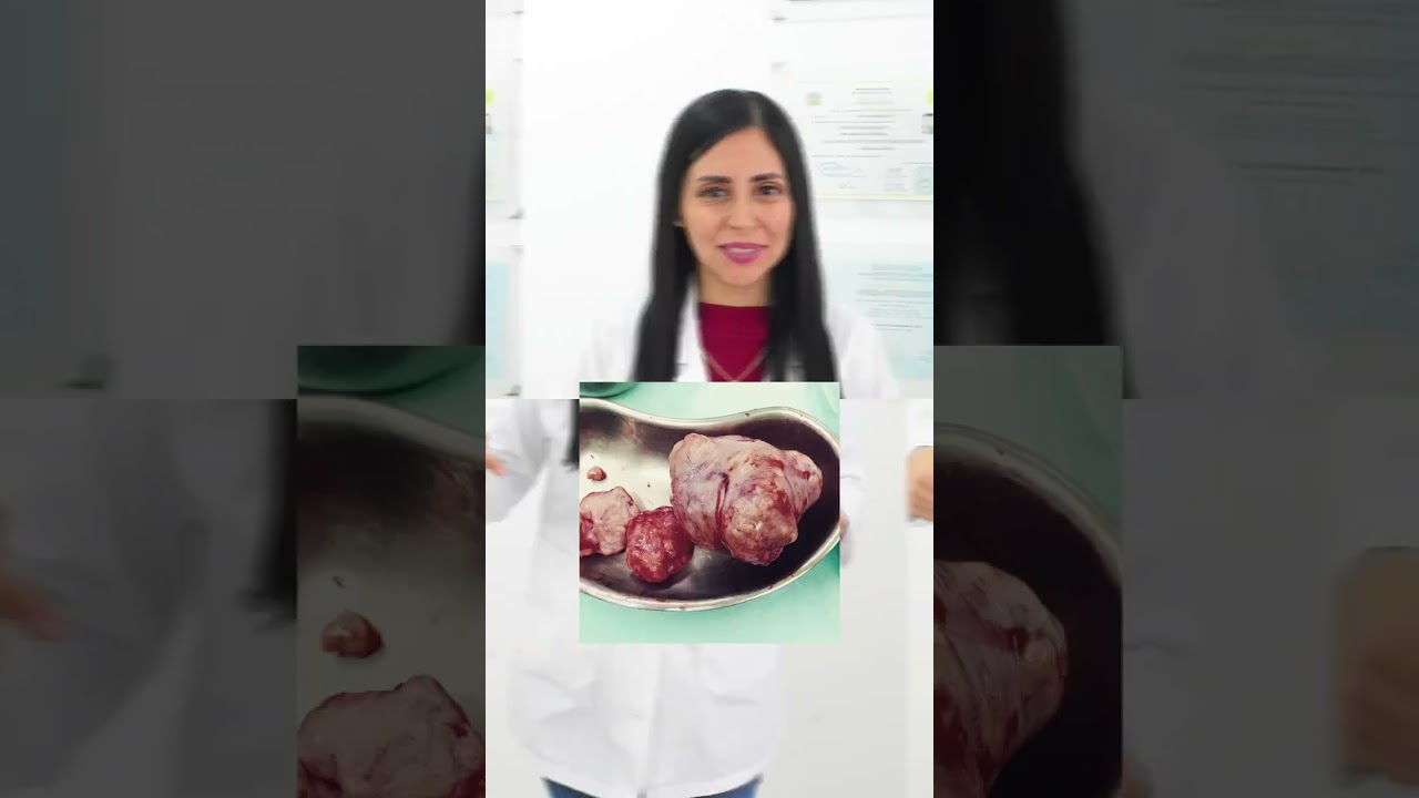 Mariella Gonzales Bolarte-39