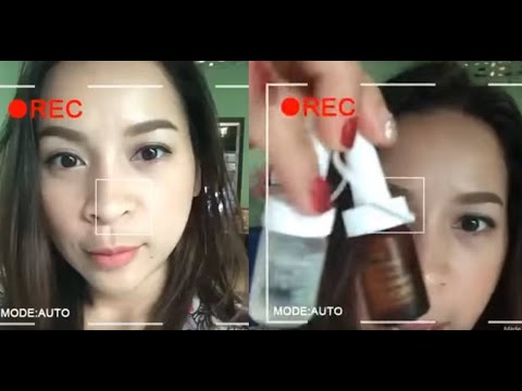 Ihtiolovaya ครีมกลาก โรคสะเก็ดเงินด้วยที่เกี่ยวข้อง