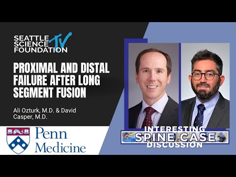 Proximal & Distal Failure After Long Segment Fusion – David Casper, MD & Ali Ozturk, MD