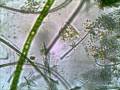 Vorticella At 400X Taken With Tucsen Microscope Camera Using TSView With Xvid Compression 2 30
