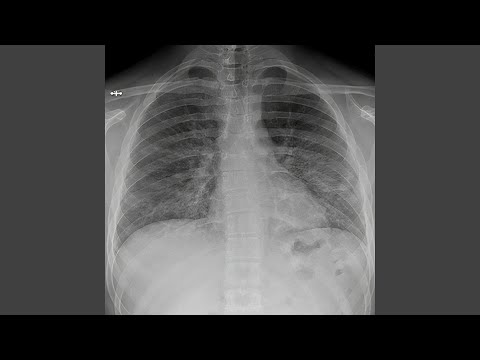 plata juul (jeeweeque flip)