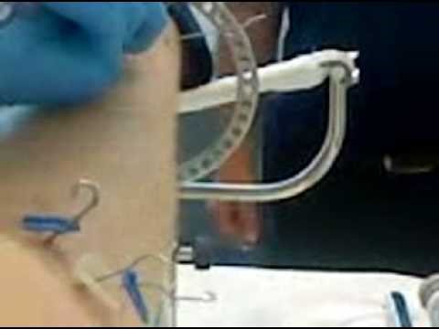 Come aumentare il suo pene senza danni Farmaci trattamento dellimpotenza