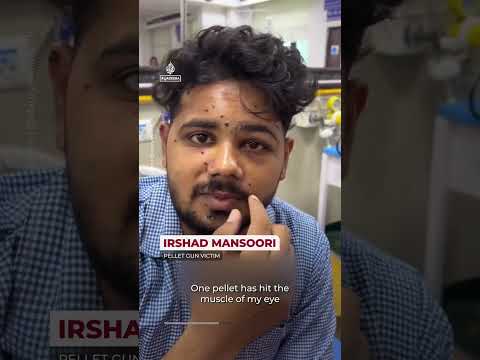 Amnesty says India used lethal weapons on ‘Cockroach’ protesters | AJ #shorts