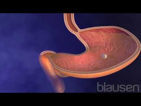 What is Diabetes? An Information Shared by Dr. Anthony Jones