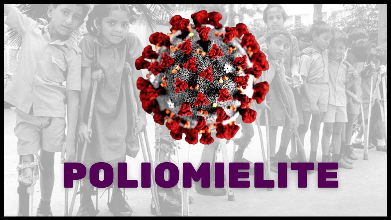 Poliomielite - Fisiologia Humana