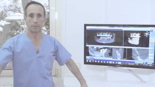 Clinica Velazquez Implantes