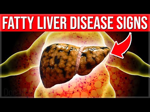 11 Bad Daily Habits That Are DESTROYING Your Liver