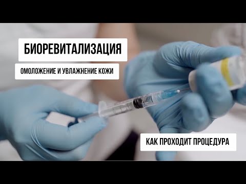 Биоревитализация