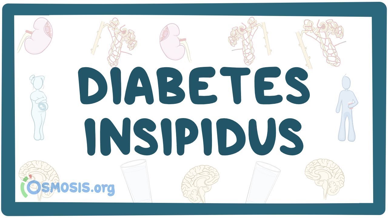 Diabetes insipidus - causes, symptoms, diagnosis, treatment, pathology