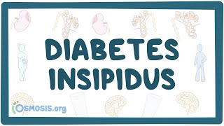 Diabetes insipidus - causes, symptoms, diagnosis, treatment, pathology