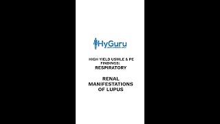 Renal Manifestations of Lupus | USMLE #shorts