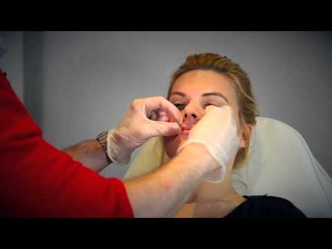 Dr David Jack London - Lip Augmentation treatment