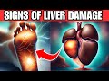 LIVER is dying! 12 weird signs of LIVER DAMAGE you must know