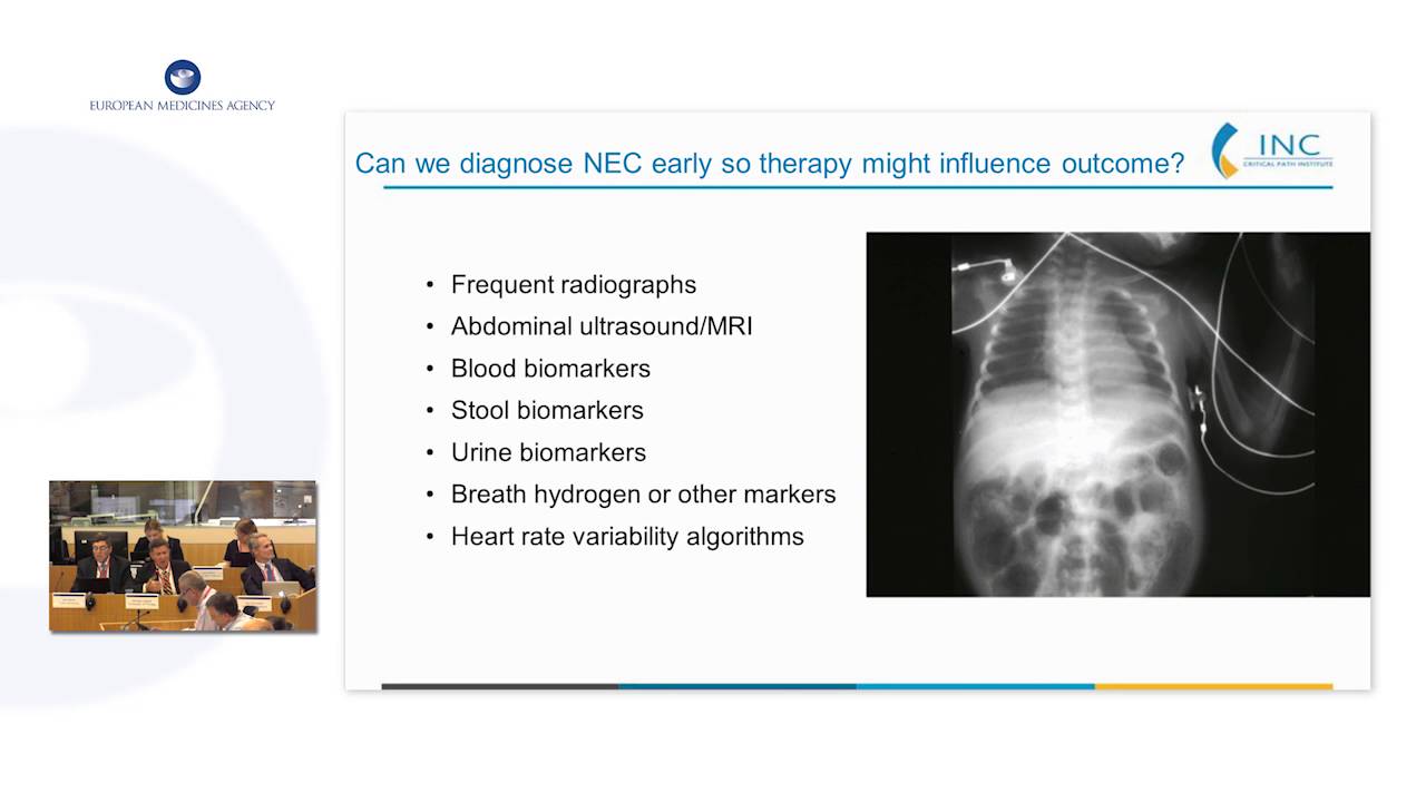 Session VI: Necrotizing Enterocolitis NEC: State of the Art - YouTube