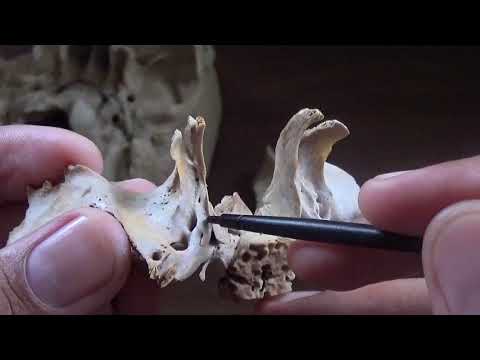 NORMA BASALIS - PART- 2/3