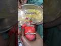 HYDROCELE Full Information I Testis Swelling In Scrotum I India I Specialist Doctor Treatment