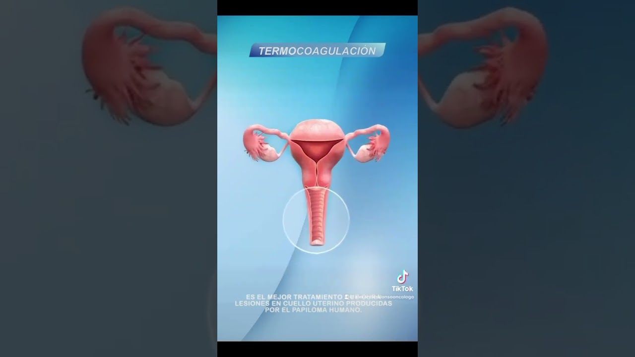 Alexander Alonso Lázaro Chumbe-36