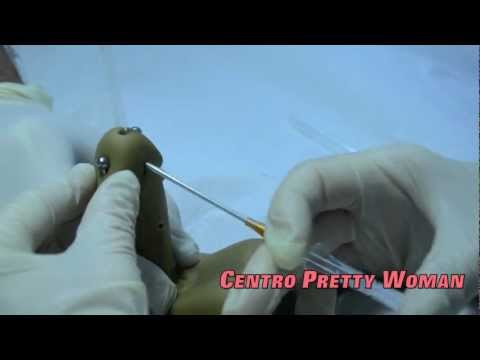 Piercing Príncipe Alberto (Prince Albert Piercing)