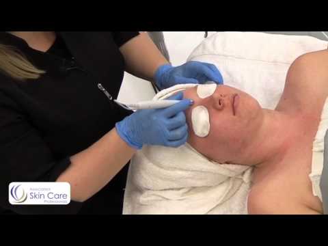 Galvanic Desincrustation Facial Technique | Associated Skin Care Professionals